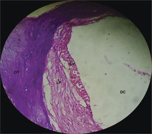 Normal looking stria vascularis, without changes in a guinea pig from the CG. 40x magnification. DC – Cochlear Duct; EV – Stria Vascularis; LP - Lamina Propria; OT – Temporal Bone.