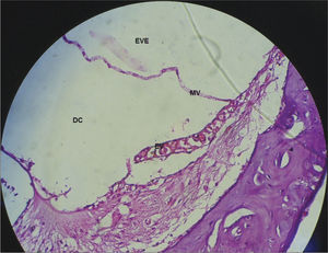 Stria vascularis without vacuolization in a guinea pig from the CG. 40x magnification. MV – Vestibular Membrane; EVE – Scala Vestibuli; DC – Cochlear Duct; EV – Stria Vascularis.