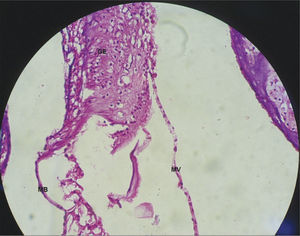 Vestibular membrane without vacuolization, intact and straight from a CG guinea pig. 40x magnification. MV – Vestibular Membrane; MB – Basilar Membrane; GE – Spiral Ganglion.