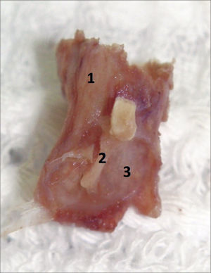 Final sample aspect, ready to be placed in a paraffin block. 1: External acoustic meatus; 2: Malleus handle inserted in the tympanic membrane mucosa; 3: Tympanic membrane mucosal membrane.