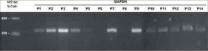 GAPDH amplification using the volumes fixed for RNA preparations. Analysis by 2% agarose gel electrophoresis dyed with ethidium bromide. Molecular weight standard = 100 bp ladder. P1-P14: patients 1 to 14.