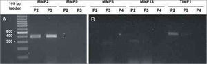 MMP and TIMP isoform amplification for selected samples. Analysis by 2% agarose gel electrophoresis dyed with ethidium bromide. Molecular weight standard = 100 bp ladder. (A) MMP-2 and MMP-9 for samples P2 and P3. (B) MMP-3, MMP-13, and TIMP-1 for samples P2, P3, and P4.