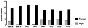 Number of right ears with normal and altered tonal auditory thresholds (> 25 DBHL) in the different frequencies.