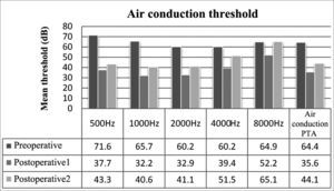 Mean air thresholds for each frequency and air PTA values.
