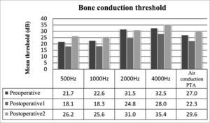Mean bone thresholds for each frequency and bone PTA values.