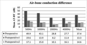Air-bone gap for each frequency and mean ABG values. AT - air threshold; BT - bone threshold.