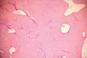 Histological aspect: dense compact bone.