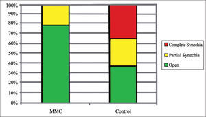 Incidence rates of middle meatus synechia types for each group.