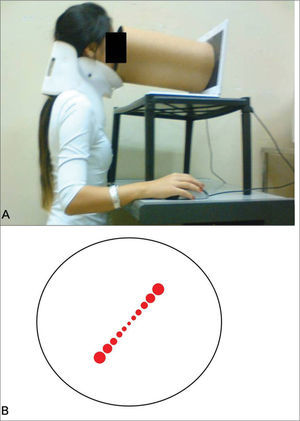 A: The SVV exam is performed in the position shown. B: A dark tube is connected to the monitor so the exam is made with no