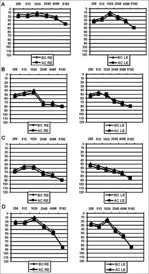 Pure tone audiometry. A: July 2, 2004; B: September 12, 2006; C: April 24, 2007; D: March 3, 2009. AC: Air Conduction; BC: Bone Conduction; RE: Right Ear; LE: Left Ear.