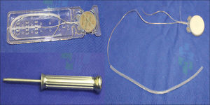 Fixation system of the internal component with titanium screws and the Neurelec Digisonic® Binaural device. Note the size of the contralateral electrode.