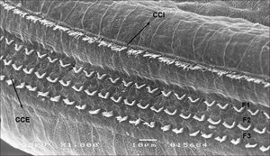 T2 of the cochlea of a guinea pig in group 1 with preserved OHC and IHC. IHC: F1: row 1; F2: row 2; F3: row 3 (SEM - 1,000x).