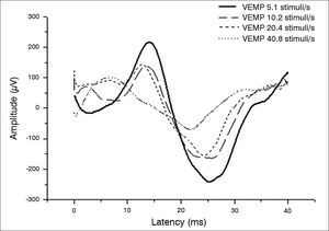 Comparison between amplitudes according to stimulation rate.