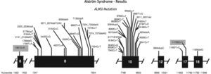 Mutation in the ALMS1 gene.