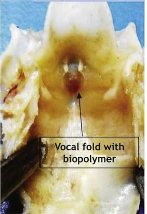 Photograph of rabbit larynx after 3 weeks of SCB implantation in the right vocal fold. Macroscopically, we observe the deletion of the groove between the vocal fold and the ipsilateral ventricular band.