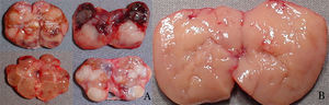Macroscopic parathyroid tissue observation: A, nodular parathyroid regions not eligible for autotransplantation; B, hyperplasic non-nodular parathyroid area eligible for autotransplantation.