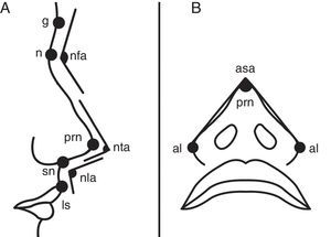 Facial and nasal soft tissue landmarks. (A) Facial soft tissue landmarks of glabella (g), nasion (n), pronasale (prn), subnasale (sn), labiale superius (ls) and angles of nasofrontal (nfa), nasal tip (nta), and nasolabial (nla) were demonstrated on lateral view. (B) Facial soft tissue landmarks of alare (al), pronasale (prn) and alar slope angle (asa) were demonstrated on basal view.