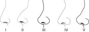 Nasal profiles in young Turkish females.