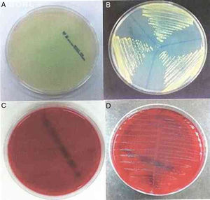 Muller-Hinton agar plates: (A) no bacterial growth; (B) with bacterial growth. Blood-Agar plates: (C) no bacterial growth; (D) with bacterial growth.