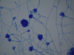 Aspergillus spp. – image under optical microscopy.