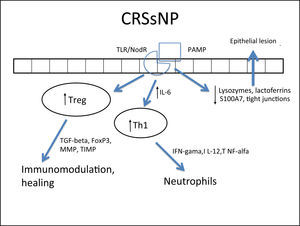 Specific response to chronic rhinosinusitis without nasal polyps (CRSsNP). After stimulation of innate immunity in the presence of high concentrations of IL-6, there is a polarized adaptive response to Th1, with associated increase in Treg. That results in neutrophil response and a modulated inflammatory process.