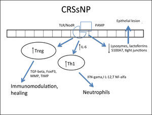 Specific response to chronic rhinosinusitis without nasal polyps (CRSsNP). After stimulation of innate immunity in the presence of high concentrations of IL-6, there is a polarized adaptive response to Th1, with associated increase in Treg. That results in neutrophil response and a modulated inflammatory process.