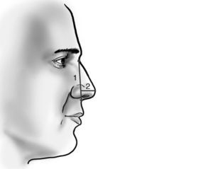 Nasal projection. Analysis of nasal projection.