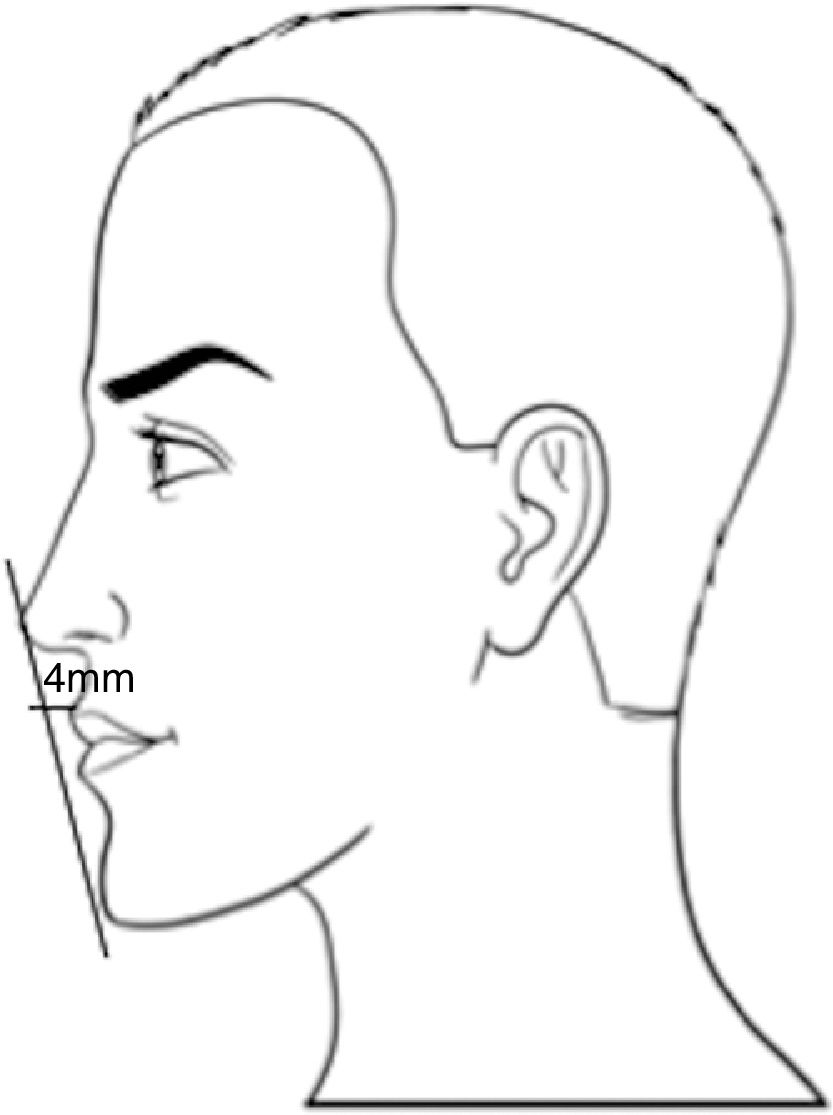 Clinical evaluation for chin augmentation: literature review and ...