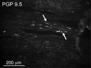 A few protein gene product (PGP) 9.5-immunoreactive nerve fibers (arrows) in the capsule of the tonsil.