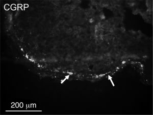 Single calcitonin gene-related peptide (CGRP)-immunoreactive nerve fibers (arrows) in the capsule of the tonsil.