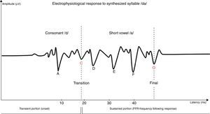 Representation of electrophysiological response to synthesized syllable /da/. Personal file of the investigator of an assessment performed with BioMARK™ software.