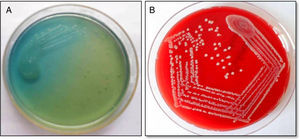 (A) Confluent growth and isolated green colonies of P. aeruginosa on nutrient agar plate; and (B) methicillin resistant colorless colonies of S. aureus (MRSA) on blood agar plate.