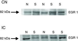 Western blots showing the immunoreactivity of Egr-1 in punches containing the DCN/pVCN and IC from naïve rats and after sodium salicylate treatment (N, naïve; S, salicylate).