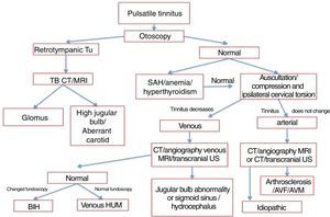Flowchart of pulsatile tinnitus investigation. Tu, tumor; CT, computed tomography; TB, temporal bones; SAH; systemic arterial hypertension; MRI; magnetic resonance imaging; US, ultrasound; BIH, benign intracranial hypertension; AVF, arteriovenous fistula; AVM, arteriovenous malformation.