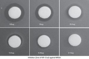 Inhibition zone test showing the antibacterial effect against MRSA. The size of the inhibition zone was dose-dependent.