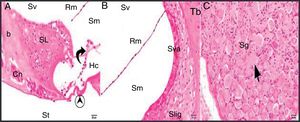 Control group: SL, spiral limbus; b, bone; Rm, Reissner's membrane; Sv, scala vestibule; Sm, scala media; St, scala tympani; round arrowhead, basilar membrane; curved arrow, tectorial membrane; Hc, inner hair cell; Cn, cochlear nerve; Sva, stria vascularis; Slig, spiral ligament; Sg, spiral ganglion; black arrow, spiral ganglion cells (hematoxylin eosin stain, ×40).