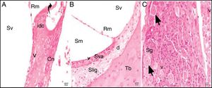 Cisplatin group: Rm, Reissner's membrane; Sv, scala vestibule; Sm, scala media; St, scala tympani; round arrowhead, basilar membrane; d, degeneration and dilatation; v, vacuolization; curved arrow, tectorial membrane; Cn, cochlear nerve; Sva, stria vascularis; Slig, spiral ligament; Sg, spiral ganglion; black arrow, spiral ganglion cells; (hematoxylin eosin stain, ×40).