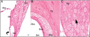 Cisplatin+100mg/kg whortleberry group; Rm, Reissner's membrane; Sv, scala vestibule; Sm, scala media; St, scala tympani; round arrowhead, basilar membrane; idc, interdental cell; Hc, inner hair cell; d, degeneration and dilatation; v, vacuolization; curved arrow, tectorial membrane; Cn, cochlear nerve; Sva, stria vascularis; Slig, spiral ligament; Sg, spiral ganglion; black arrow, spiral ganglion cells; (hematoxylin eosin stain, ×40).