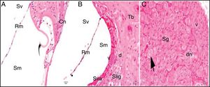 Cisplatin+200mg/kg whortleberry group; Rm, Reissner's membrane; Sv, scala vestibule; Sm, scala media; St, Scala tympani; round arrowhead, basilar membrane; idc, interdental cell; Hc, inner hair cell; d, degeneration and dilatation; v, vacuolization; curved arrow, tectorial membrane; Cn, cochlear nerve; Sva, stria vascularis; Slig, spiral ligament; Sg, spiral ganglion; black arrow, spiral ganglion cells; (hematoxylin eosin stain, ×40).