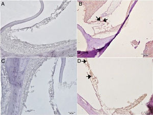 Immunohistochemical examination of the cochlea, IP, Bar: 5μm. (A) Control Group, negative Caspase-3 expression in the outer hair cells. (B) Cisplatin Group, severe Caspase-3 immunopositivity in outer hair cells (arrow). (C) Gallic acid Group, negative Caspase-3 expression in the outer hair cells. (D) Cisplatin+Gallic acid Group, mild Caspase-3 immunopositivity in outer hair cells (arrow).
