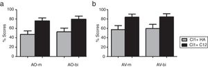 Auditory-only (a) and audiovisual (b) speech perception performance with CI1+HA and CI1+CI2 (m, monosyllable recognition; bi, bisyllable recognition).