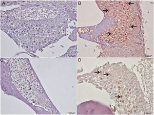 Immunohistochemical examination of the cochlea, IP, bar: 50μm. (A) Control Group. Negative 8-OHdG expression in spiral ganglia. (B) Cisplatin group. Severe 8-OHdG immunopositivity in spiral ganglia (arrow). (C) Eugenol group: negative 8-OHdG expression in spiral ganglia. (D) Cisplatin+eugenol group: mild 8-OHdG immunopositivity in spiral ganglia (arrow).