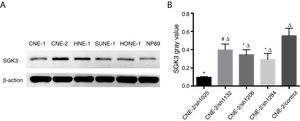 Detection of SGK3 protein expression in NPC cell lines. (A) Representative SGK3 protein expression in different NPC cell lines and NP69 cells detected by western blot analysis. (B) Analysis of the gray value of SGK3 protein expression as the ratio of SGK3 to β-actin in the western blot results; SGK3 was more highly expressed in most NPC cell lines (CNE-2, HNE-1, SUNE-1) than in NP69 cells (p<0.01).