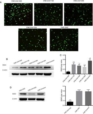 The best SGK3 shRNA screening and efficiency of SGK3 silencing by the specific shRNA in CNE-2 cells. (A) GFP expression in CNE-2 cells observed by fluorescence microscopy after transfection with the SGK3 shRNA or NC plasmid. (B) Representative SGK3 protein expression in CNE-2 cells treated with different SGK3 shRNA plasmids determined by western blot analysis. (C) Analysis of the gray value of SGK3 protein expression as the ratio of SGK3 to β-actin in western blot results. The sh1025 plasmid had the most significant effect on SGK3 knockdown (p<0.01). (D) Representative SGK3 protein expression in shSGK3, NC and control groups determined by western blot analysis. (E) Analysis of the gray value of SGK3 protein expression as the ratio of SGK3 to β-actin in western blot results; expression of SGK3 in the shSGK3 group was obviously reduced compared with that in the NC and control groups (*#p<0.01).