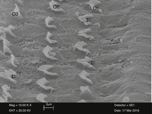 View of irregular and adhered stereocilia (⇇) of outer hair cells (O1-O2-O3) in the cisplatin plus NAC group (10,000×).