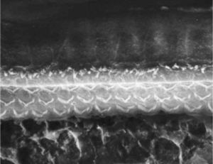 Photograph of the organ of Corti region of a guinea pig from Group 2 (use of EDTA and toluidine blue, without osmium tetroxide), with the presence of a fracture next to the outer hair cells.