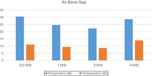 Results of air bone gap.