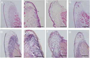 Histological examination. Sections were stained with Hematoxylin and Eosin (H&E), as well as Elastica van Gieson (EVG). Uninjured vocal folds were prepared as controls (A and B). The surface of the injured vocal folds is irregular with marked deformation covered by thick epithelium. Collagen fibers are diffusely distributed in the lamina propria (C and D). In the gelatin hydrogel microspheres injection without bFGF, the irregular elevation of mucosal surface with deformation was observed. The collagen density was slightly decreased relative to the injured vocal folds (E and F). Injection of gelatin hydrogel microspheres with bFGF recovered the normal structure of the vocal folds, which were composed of a flat surface and an orderly arranged collagen layer (G and H); (200μm scale bar) (A, C, E and G were stained with H&E, and B, D, F and H with EVG).