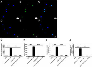 Expression of IL-13 in nuocytes, and responses of mesenteric Lymph Node (mLN)-derived nuocytes to mouse recombinant (rm) Interleukin (IL)-25 and IL-33 in the culture. A, IL-13 in wild-type mice [4′, 6-Diamidino-2-phenylindole dihydrochloride (DAPI)]. B, IL-13 in wild-type mice (fluorescein isothiocyanate). C, IL-13 in wild-type mice (merge). D, IL-13 in Il17br−/−Il1rl1−/− mice (DAPI). E, IL-13 in Il17br−/−Il1rl1−/− mice (fluorescein isothiocyanate). F, IL-13 in Il17br−/−Il1rl1−/− mice (merge). G, IL-5 in the culture. H, IL-13 in the culture. I, IL-5 mRNA in nuocytes. J, IL-13 mRNA in nuocytes. Scale bars: 10 μm. Original magnification: ×400. Each value represents the mean (SEM) of 6 mice in each group. Wild, wild-type mice; Wild (IL-25+IL-33), wild-type mice with the treatment of rmIL-25+rmIL-33; Il17br−/−Il1rl1−/−, Il17br−/−Il1rl1−/−mice; Il17br−/−Il1rl1−/− (IL-25+IL-33), Il17br−/−Il1rl1−/− mice with the treatment of rmIL-25+rmIL-33. ****p < 0.0001 vs. Wild (IL-25 + IL-33). ***p < 0.001 vs. Wild (IL-25+IL-33).