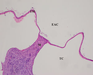 Control group, Tympanic membrane structure and malleus attached to membrane; H&E ×100. (EAC, External Auditory Canal; TC, Tympanic Cavity; TM, Tympanic Membrane; M, Malleus; H&E, Hematoxylin and Eosin).